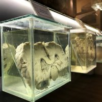 Sağlık Tarihi Müzesi’ne rekor ziyaretçi 